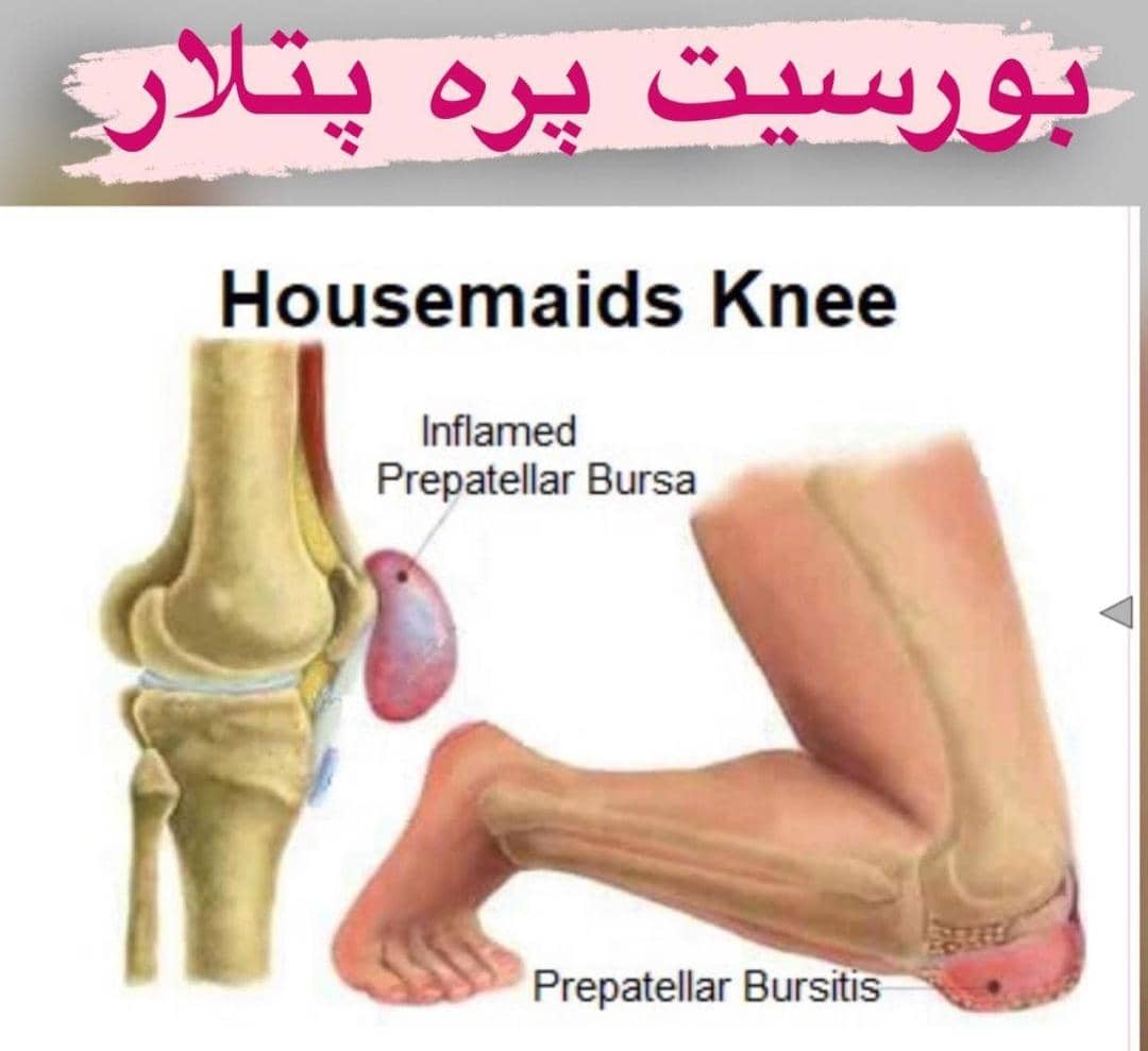 کلینیک طب فیزیکی و توانبخشی دکتر نیکبخت در همدان ، آدرس کلینیک طب فیزیکی و توانبخشی دکتر نیکبخت در همدان ، ایران مشاغل سامانه برتر ثبت مشاغل کشور