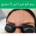 کلینیک زیبایی پوست و مو هیلدا در تبریز