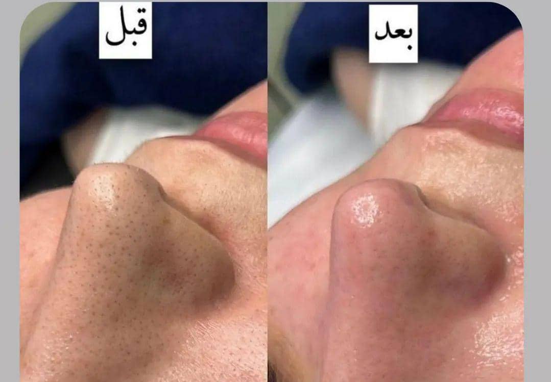 سالن پاکسازی پوست و فیشیال vip چهره به چهره در شهرکرد ، آدرس سالن پاکسازی پوست و فیشیال vip چهره به چهره در شهرکرد ، سالن پاکسازی پوست و فیشیال vip در شهرکرد ، ایران مشاغل سامانه برتر ثبت مشاغل کشور