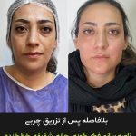 مطب زیبایی دکتر وحید عباس نژاد در صادقیه تهران