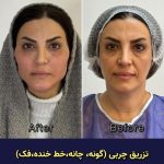 مطب زیبایی دکتر وحید عباس نژاد در صادقیه تهران