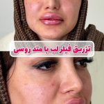 مطب زیبایی دکتر وحید عباس نژاد در صادقیه تهران