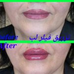 مطب زیبایی پوست و مو گلوریا در رشت