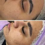 خدمات تخصصی فشیال و پاکسازی پوست صدیقه خیرمند در رفسنجان