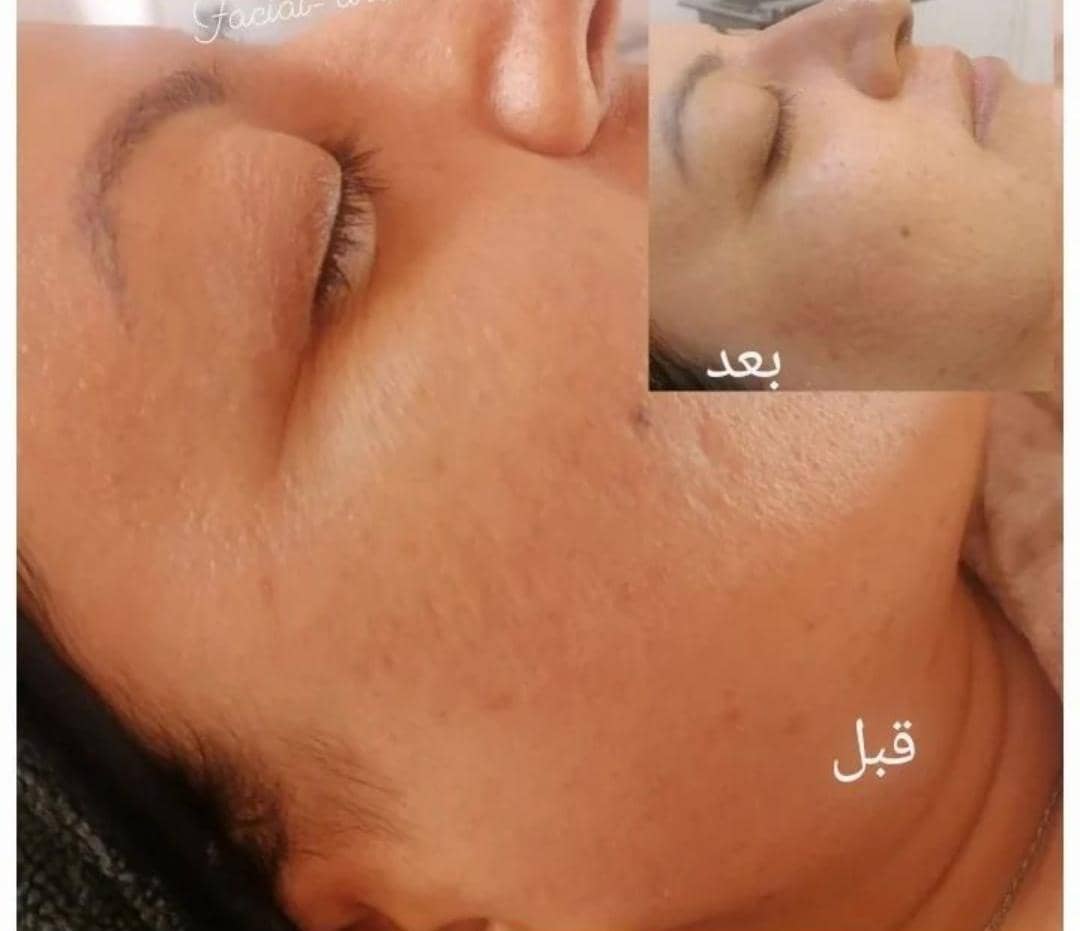 خدمات تخصصی فشیال و پاکسازی پوست صدیقه خیرمند در رفسنجان ،آدرس خدمات تخصصی فشیال و پاکسازی پوست صدیقه خیرمند در رفسنجان، ایران مشاغل سامانه برتر ثبت مشاغل کشور