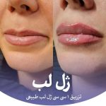 کلینیک زیبایی و لیزر تندیس در باغستان غربی کرج