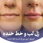 کلینیک زیبایی و لیزر تندیس در باغستان غربی کرج