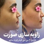 کلینیک زیبایی و لیزر تندیس در باغستان غربی کرج