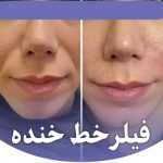 کلینیک زیبایی و لیزر تندیس در باغستان غربی کرج