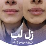 کلینیک زیبایی و لیزر تندیس در باغستان غربی کرج