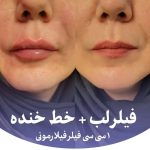 کلینیک زیبایی و لیزر تندیس در باغستان غربی کرج