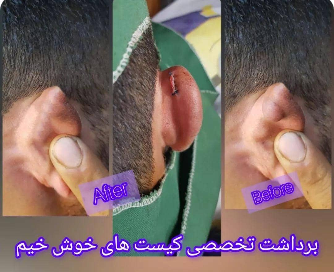 مطب زیبایی پوست و مو دکتر محمود صادقلو در آزادشهر ، ادرس مطب زیبایی پوست و مو دکتر محمود صادقلو در آزادشهر، ایران مشاغل سامانه برتر ثبت مشاغل کشور