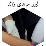 مرکز تخصصی لیزر موهای زائد پارادایس در تبریز