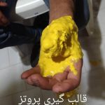 طراحی و ساخت دست و انگشت مصنوعی ارتوپد فنی یزدان در یزد