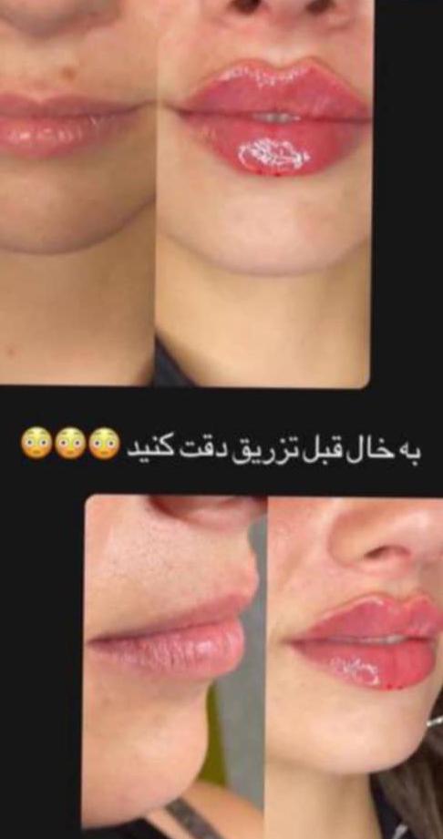 مطب تخصصی زیبایی پوست و مو سیما در گوهردشت کرج ، آدرس مطب تخصصی زیبایی پوست و مو سیما در گوهردشت کرج ، ایران مشاغل سامانه برتر ثبت مشاغل کشور