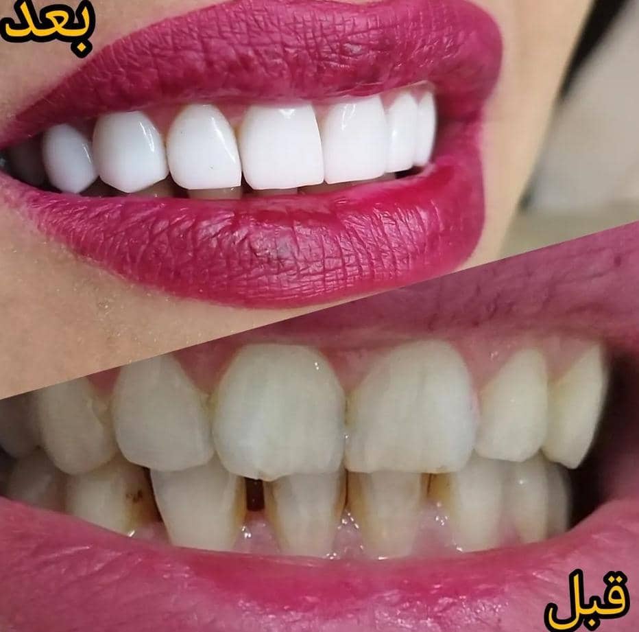 مطب دندانپزشکی ونوس در کرمانشاه ، آدرس مطب دندانپزشکی ونوس در کرمانشاه ، ایران مشاغل سامانه برتر ثبت مشاغل کشور