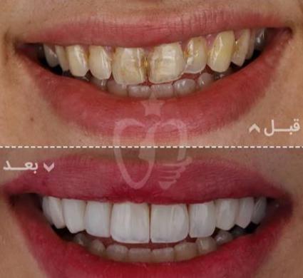 مطب دندانپزشکی شادی در اندرزگو تهران ، آدرس مطب دندانپزشکی شادی در اندرزگو تهران ، ایران مشاغل سامانه برتر ثبت مشاغل کشور