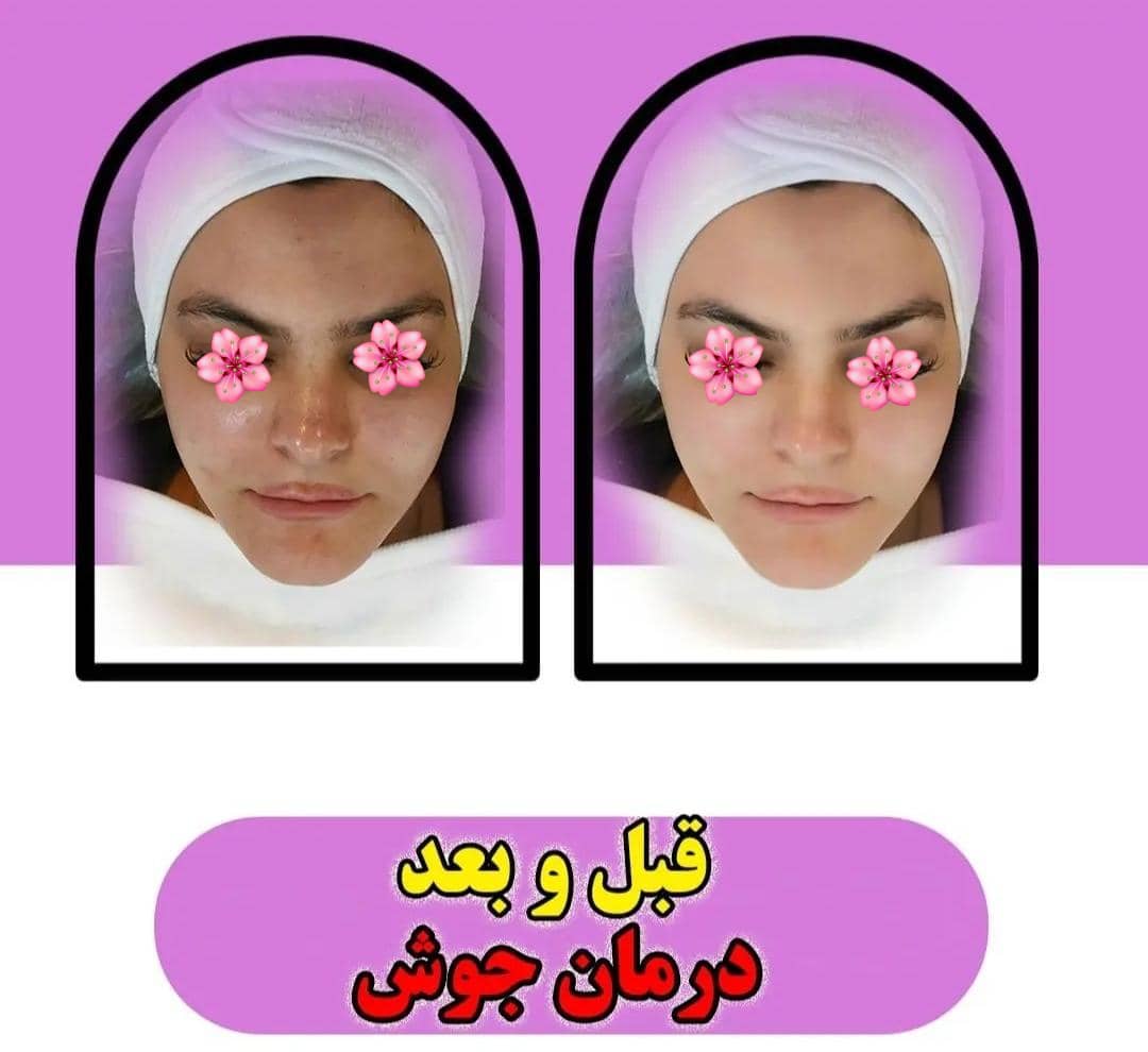 خدمات تخصصی پاکسازی پوست و فیشیال صورت شادی ملکشاهی در اصفهان ، آدرس خدمات تخصصی پاکسازی پوست و فیشیال صورت شادی ملکشاهی در اصفهان، ایران مشاغل سامانه برتر ثبت مشاغل کشور