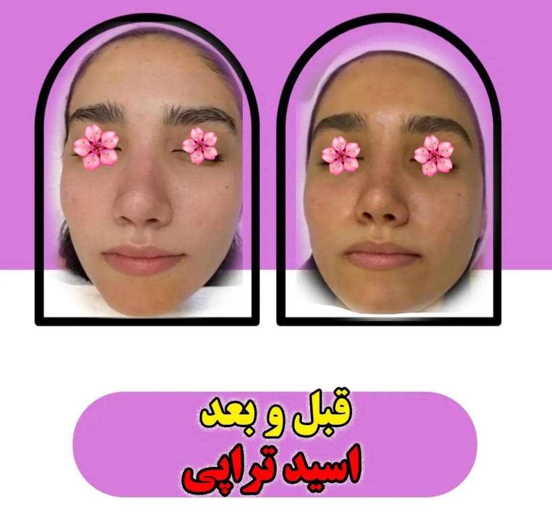 خدمات تخصصی پاکسازی پوست و فیشیال صورت شادی ملکشاهی در اصفهان ، آدرس خدمات تخصصی پاکسازی پوست و فیشیال صورت شادی ملکشاهی در اصفهان، ایران مشاغل سامانه برتر ثبت مشاغل کشور