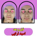 خدمات تخصصی پاکسازی پوست و فیشیال صورت شادی ملکشاهی در اصفهان