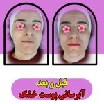 خدمات تخصصی پاکسازی پوست و فیشیال صورت شادی ملکشاهی در اصفهان