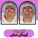 خدمات تخصصی پاکسازی پوست و فیشیال صورت شادی ملکشاهی در اصفهان