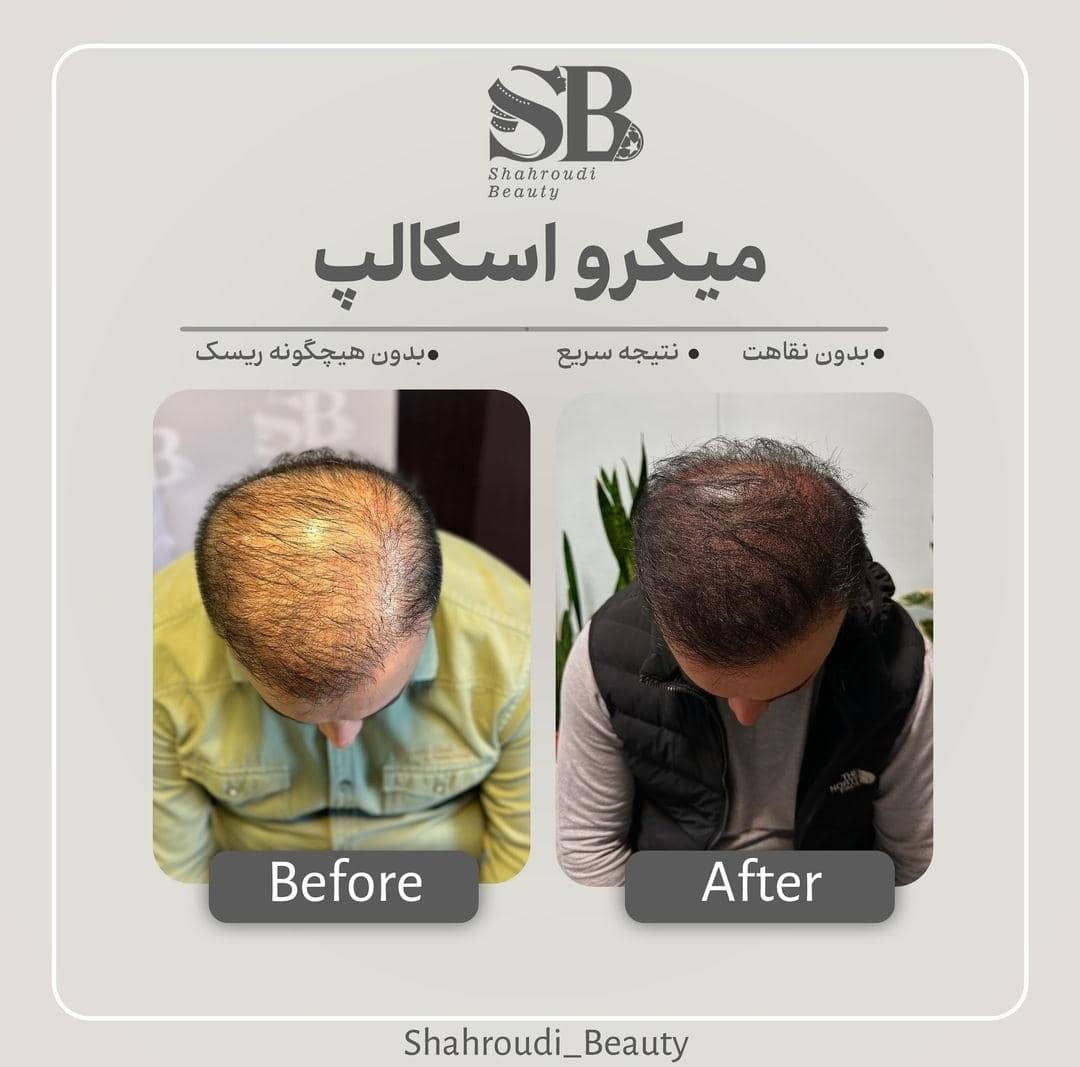 مرکز تخصصی میکرواسکالپ سر شاهرودی طب در سعادت آباد تهران ، آدرس مرکز تخصصی میکرواسکالپ سر شاهرودی طب در سعادت آباد تهران ، ایران مشاغل سامانه برتر ثبت مشاغل کشور