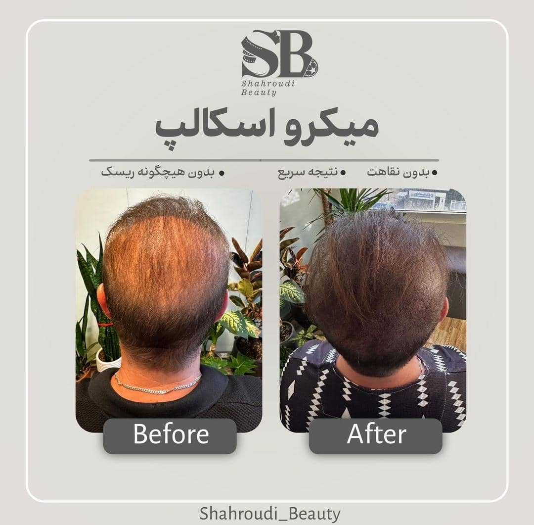 مرکز تخصصی میکرواسکالپ سر شاهرودی طب در سعادت آباد تهران ، آدرس مرکز تخصصی میکرواسکالپ سر شاهرودی طب در سعادت آباد تهران ، ایران مشاغل سامانه برتر ثبت مشاغل کشور