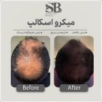 مرکز تخصصی میکرواسکالپ سر شاهرودی طب در سعادت آباد تهران