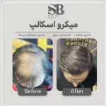 مرکز تخصصی میکرواسکالپ سر شاهرودی طب در سعادت آباد تهران