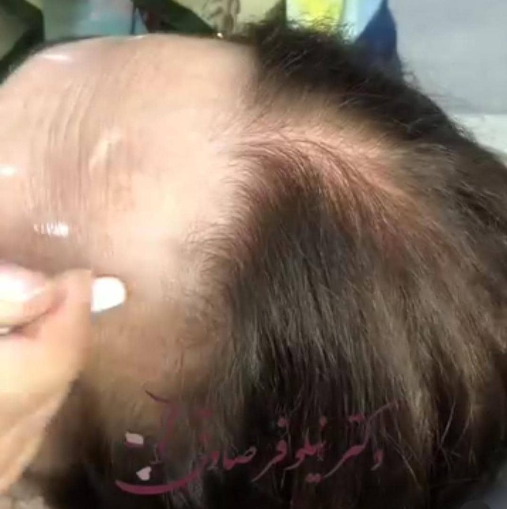 کلینیک زیبایی و لیزر نیلوفر در جردن تهران