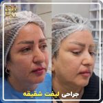 مطب دکتر مصطفی دوستانی جراح و متخصص پوست مو و زیبایی در تبریز