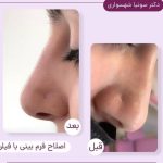 کلینیک زیبایی دکتر سونیا شهسواری در سنندج