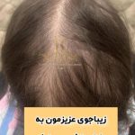 مرکز تخصصی کاشت مو رسول زاده در آبادان