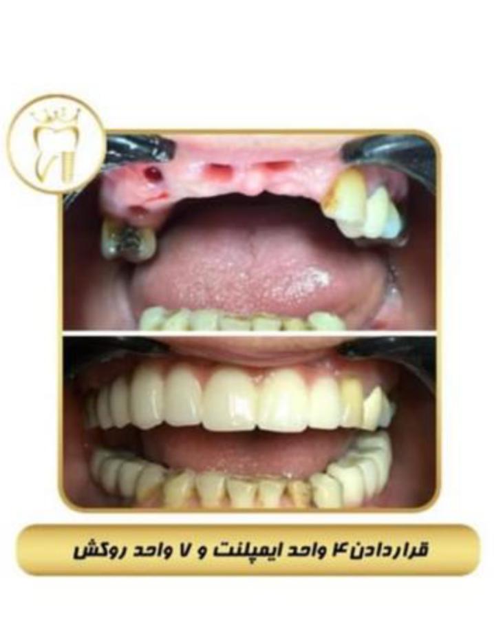 مرکز تخصصی ایمپلنت دندان دکتر شهرزاد شاه بیک در پاسداران تهران ، آدرس مرکز تخصصی ایمپلنت دندان دکتر شهرزاد شاه بیک در پاسداران تهرانف ایران مشاغل سامانه برتر ثبت مشاغل کشور