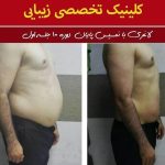 کلینیک لاغری روژینا نادری در اهواز