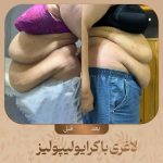 مرکز تناسب اندام و لاغری آریل دایت در مشهد