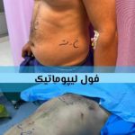 مطب زیبایی دکتر مقصودلو در دولت تهران