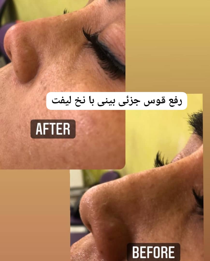 مطب زیبایی پوست و مو دکتر شهرزاد پرویزی در مشهد ،آدرس مطب زیبایی پوست و مو دکتر شهرزاد پرویزی در مشهد ،ایران مشاغل سامانه برتر ثبت مشاغل کشور