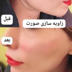 مطب زیبایی پوست و مو دکتر شهرزاد پرویزی در مشهد