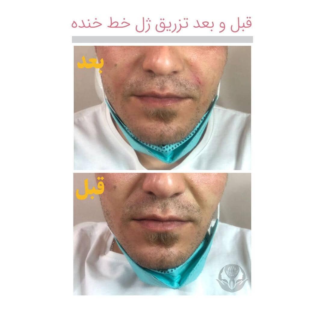 مطب زیبایی پوست و مو دکتر آزاده احمدی در مشهد ،آدرس مطب زیبایی پوست و مو دکتر آزاده احمدی در مشهد ،ایران مشاغل سامانه برتر ثبت مشاغل کشور