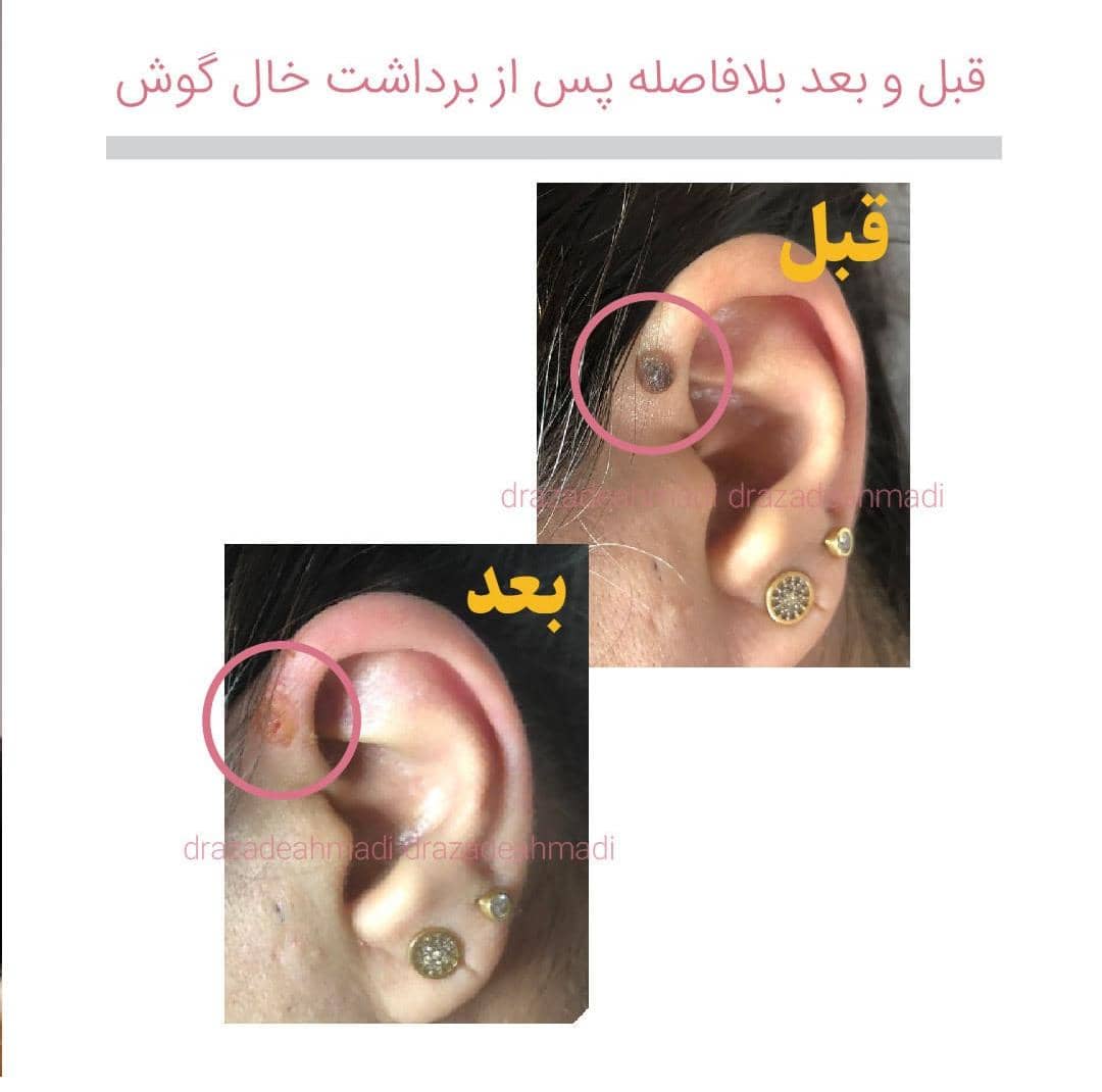 مطب زیبایی پوست و مو دکتر آزاده احمدی در مشهد ،آدرس مطب زیبایی پوست و مو دکتر آزاده احمدی در مشهد ،ایران مشاغل سامانه برتر ثبت مشاغل کشور