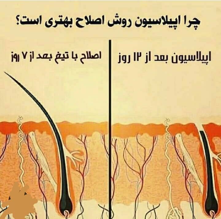 اپیلاسیون ۱×۲ در همدان ، آدرس اپیلاسیون ۱×۲ در همدان ، ایران مشاغل سامانه برتر ثبت مشاغل کشور