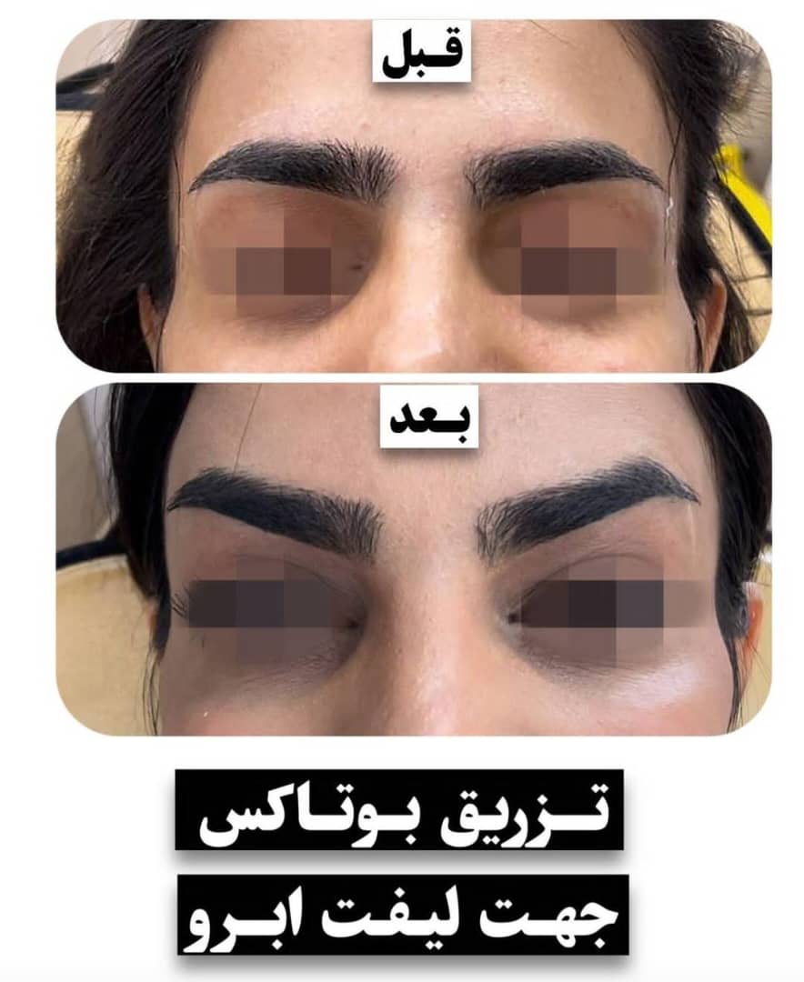 پزشک زیبایی پوست و مو دکتر عاطفه صمیمی در خمینی شهر، آدرس پزشک زیبایی پوست و مو دکتر عاطفه صمیمی در خمینی شهر ، ایران مشاغل سامانه برتر ثبت مشاغل کشور