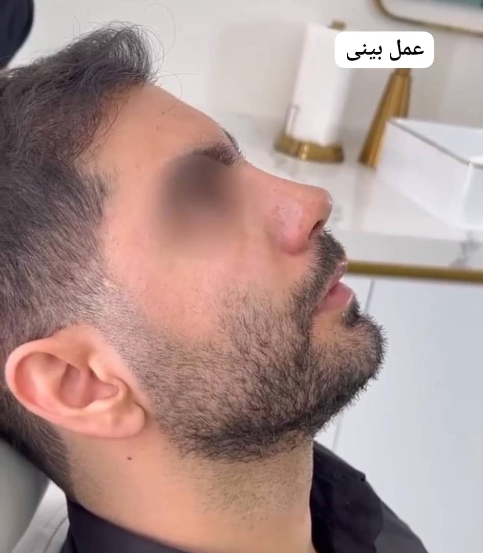 جراحی زیبایی بینی و صورت - جراحی زیبایی بینی و صورت دکتر سارا ارژنگ در تهران