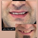 کلینیک دندانپزشکی پارس در مطهری تربت حیدریه