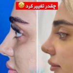 کلینیک زیبایی مهرزاد در رازی شاهین شهر