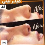 مطب زیبایی دکتر مهسا کاوئی در اراک