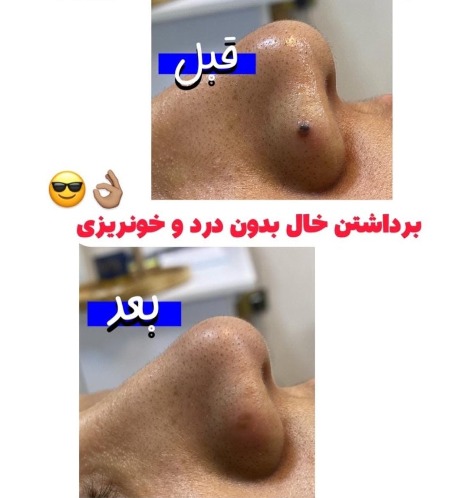 کلینیک زیبایی آرزو در سه راه پلنگ صورتی بندرعباس ، آدرس کلینیک زیبایی آرزو در سه راه پلنگ صورتی بندرعباس ، ایران مشاغل سامانه برتر ثبت مشاغل کشور