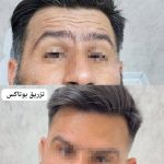 مطب زیبایی پوست و مو لامور در کرمان